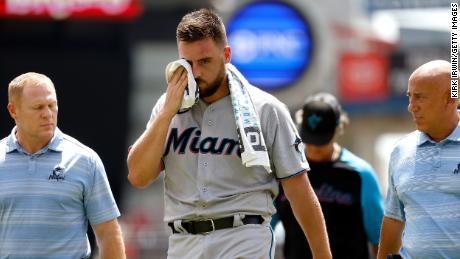 Miami Marlins’ Daniel Castano hit in head by 104mph line drive