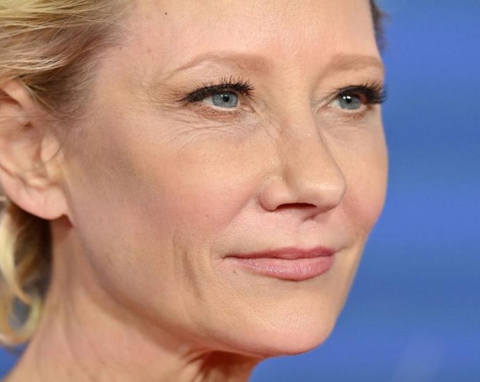 Anne Heche hospitalized following fiery car crash