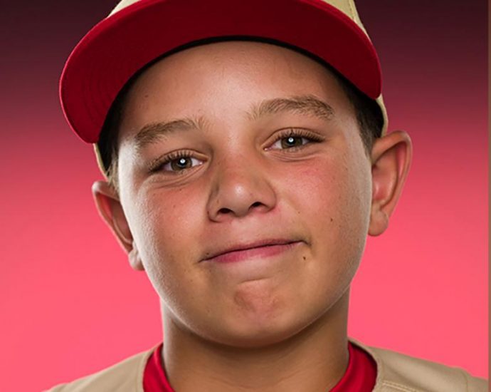 Little League World Series player in critical condition after falling from a bunk bed