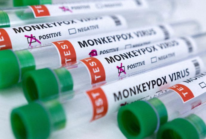 Nigerian monkeypox patient faces charges, deportation from Cambodia