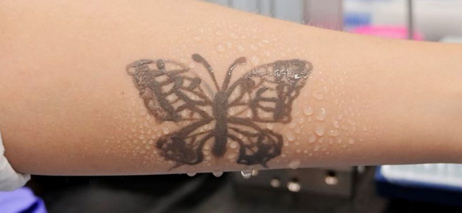 South Korea develops nanotech tattoo as health monitoring device