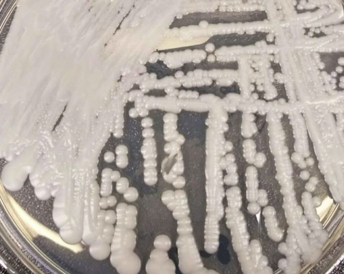 38 cases of Candida auris fungal infection reported to MOH since 2019