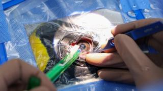 Singapore: The penguins given world-first cataract surgery