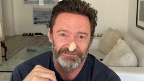 Hugh Jackman: Wolverine star gets skin cancer all clear