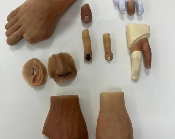 Prosthetics get new lease on life