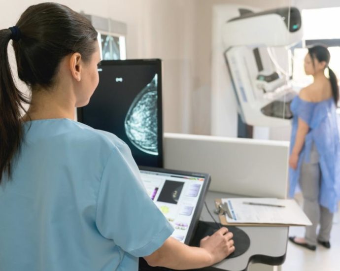 Commentary: Singapore women shouldn’t put off breast cancer screening
