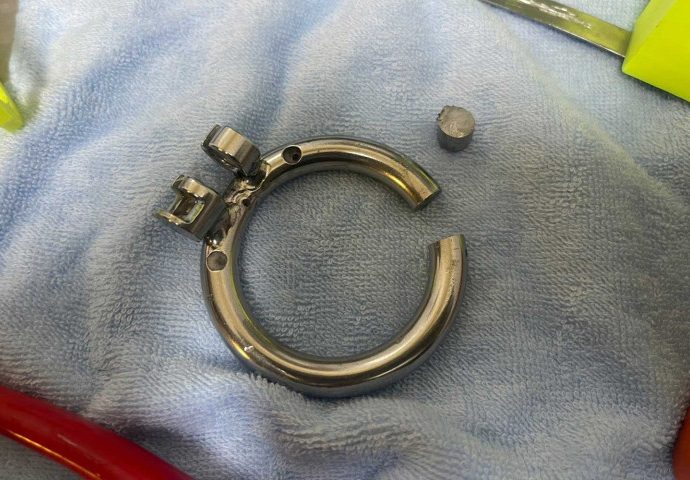 Ring removed from tourist’s thing