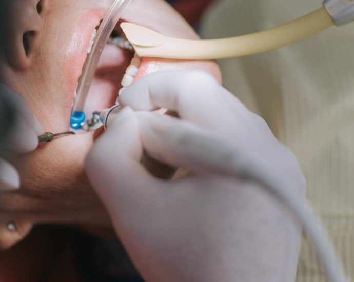 ‘Takes time and experience to do well’: Why root canal treatments can cost thousands of dollars