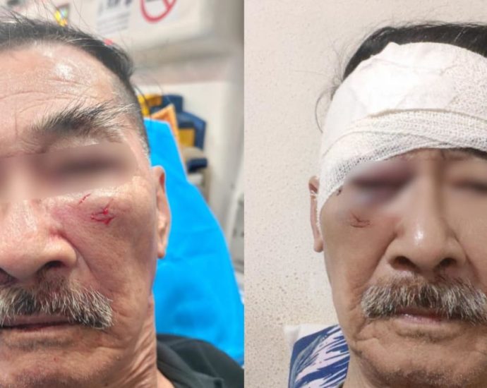 80-year-old security officer allegedly punched in the face while on duty at Bedok Central