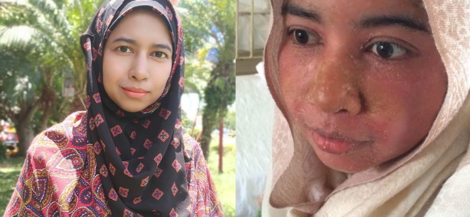 She got her masterâs degree and raised four children, even as she battled a painful, incurable skin disease