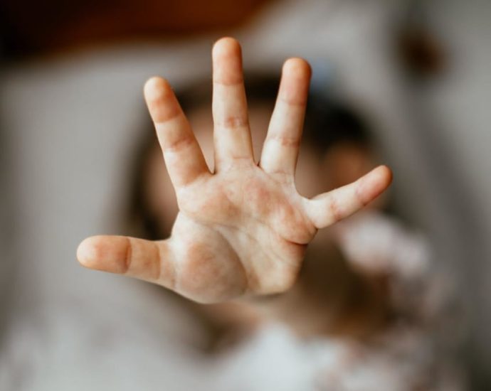 MSF to launch standardised tools for frontline workers to better detect, report domestic violence