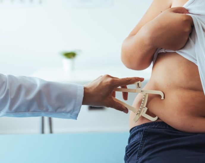 Commentary: What if managing obesity isn’t just about sheer willpower?