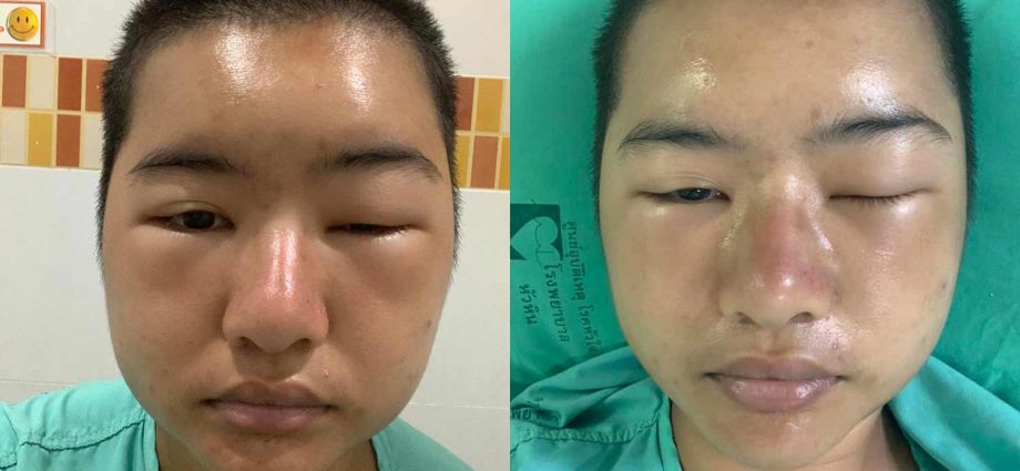 Police probe trainee”s complaint of physical, mental abuse