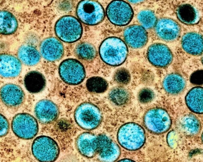 CNA Explains: Mpox has a new, deadlier and more transmissible variant – just how dangerous is it?