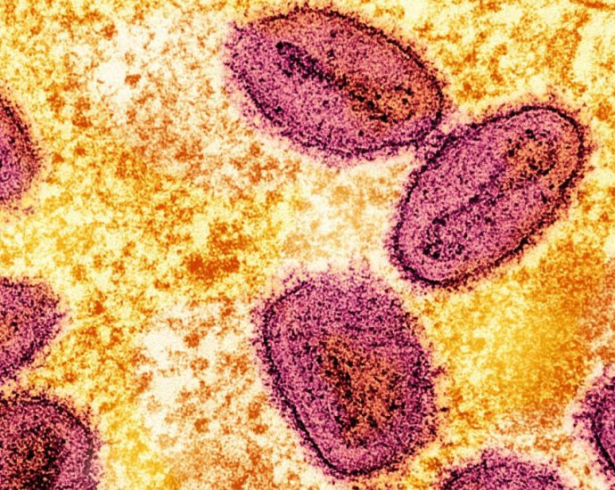 Philippines detects first mpox case this year, yet to determine strain