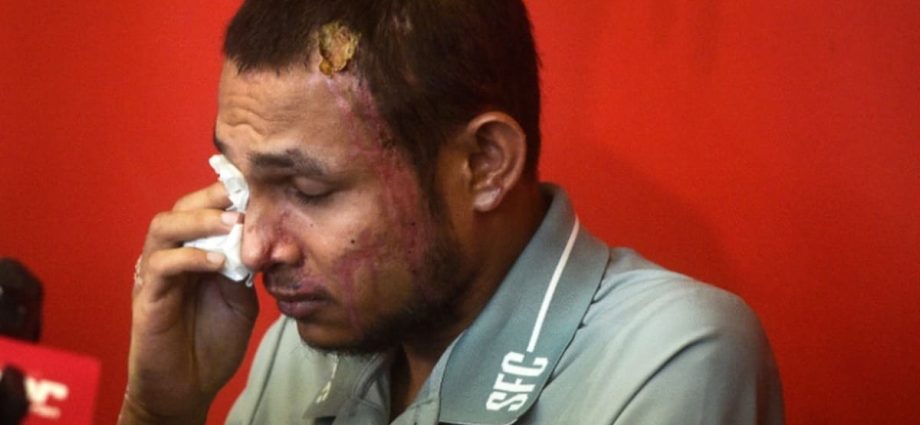 Malaysian footballer acid attack: ‘No further action’ from public prosecutor but police will continue probe