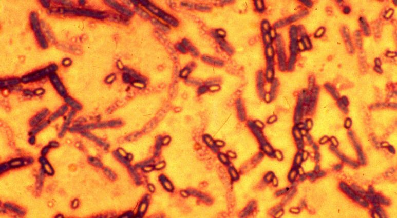 Mukdahan officials deny report of new anthrax death